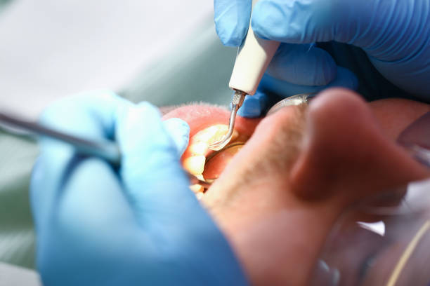 Best Emergency Denture Repair in Unadilla, GA